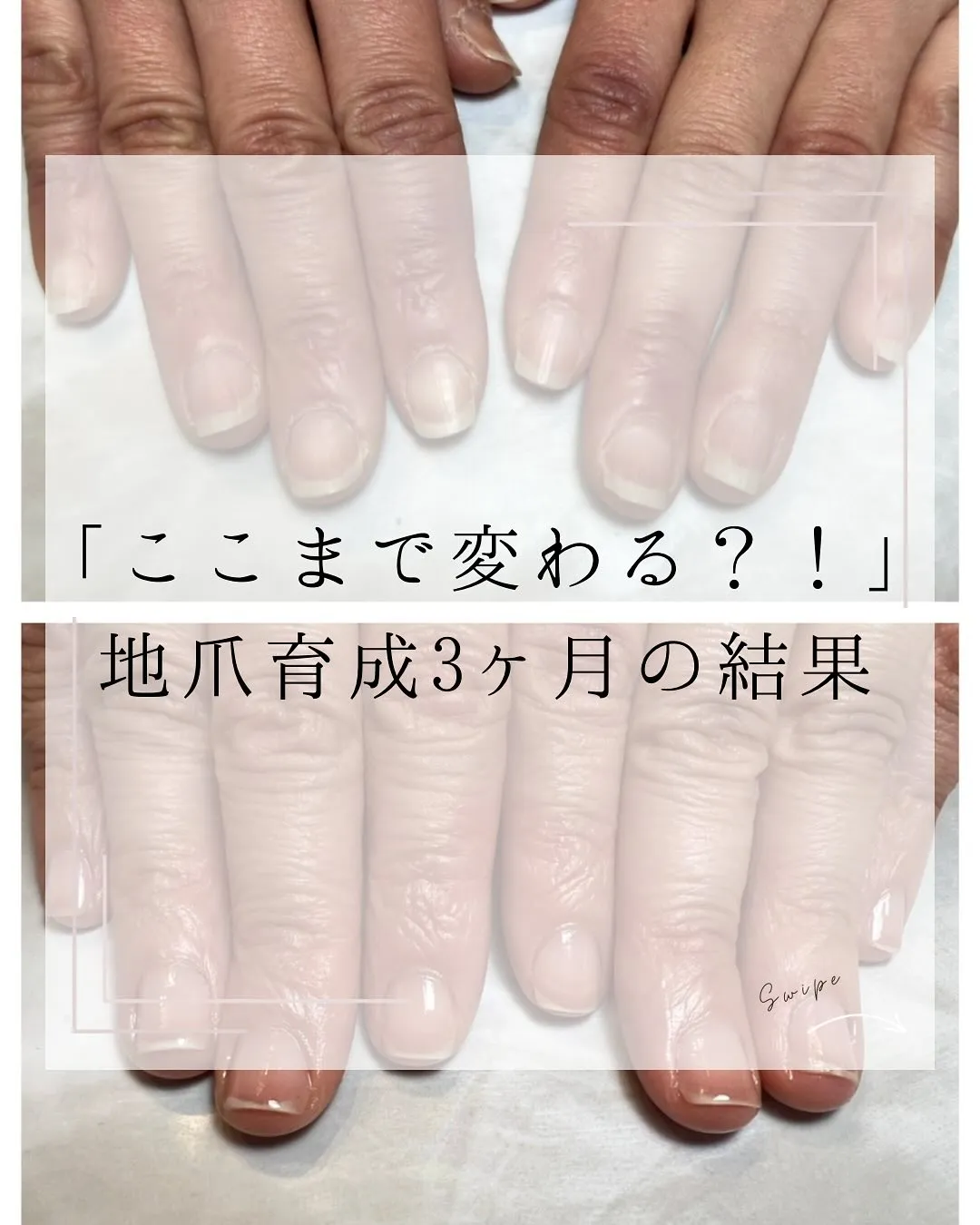 「ここまで変わる？！」地爪育成3ヶ月の結果