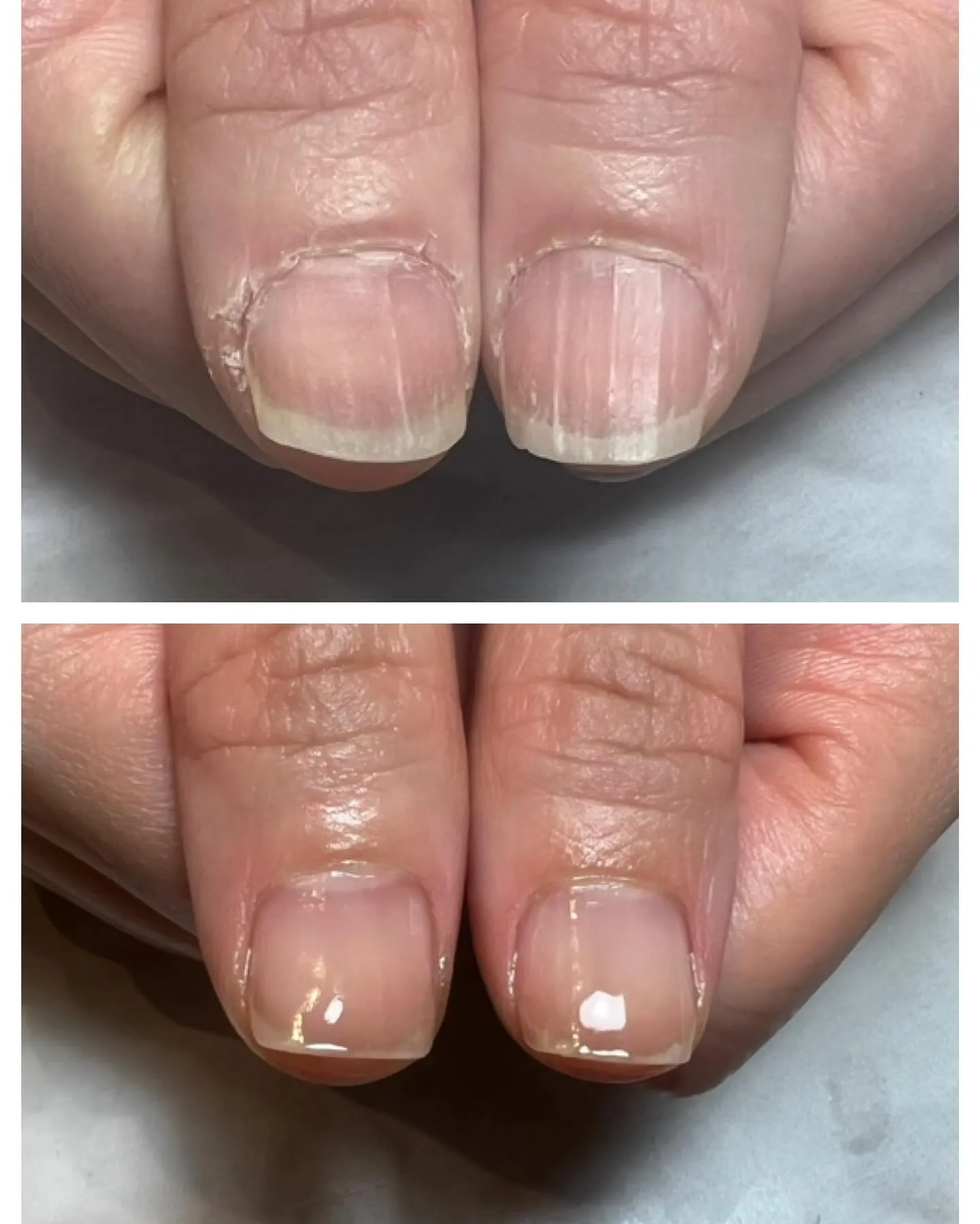 「ここまで変わる？！」地爪育成3ヶ月の結果