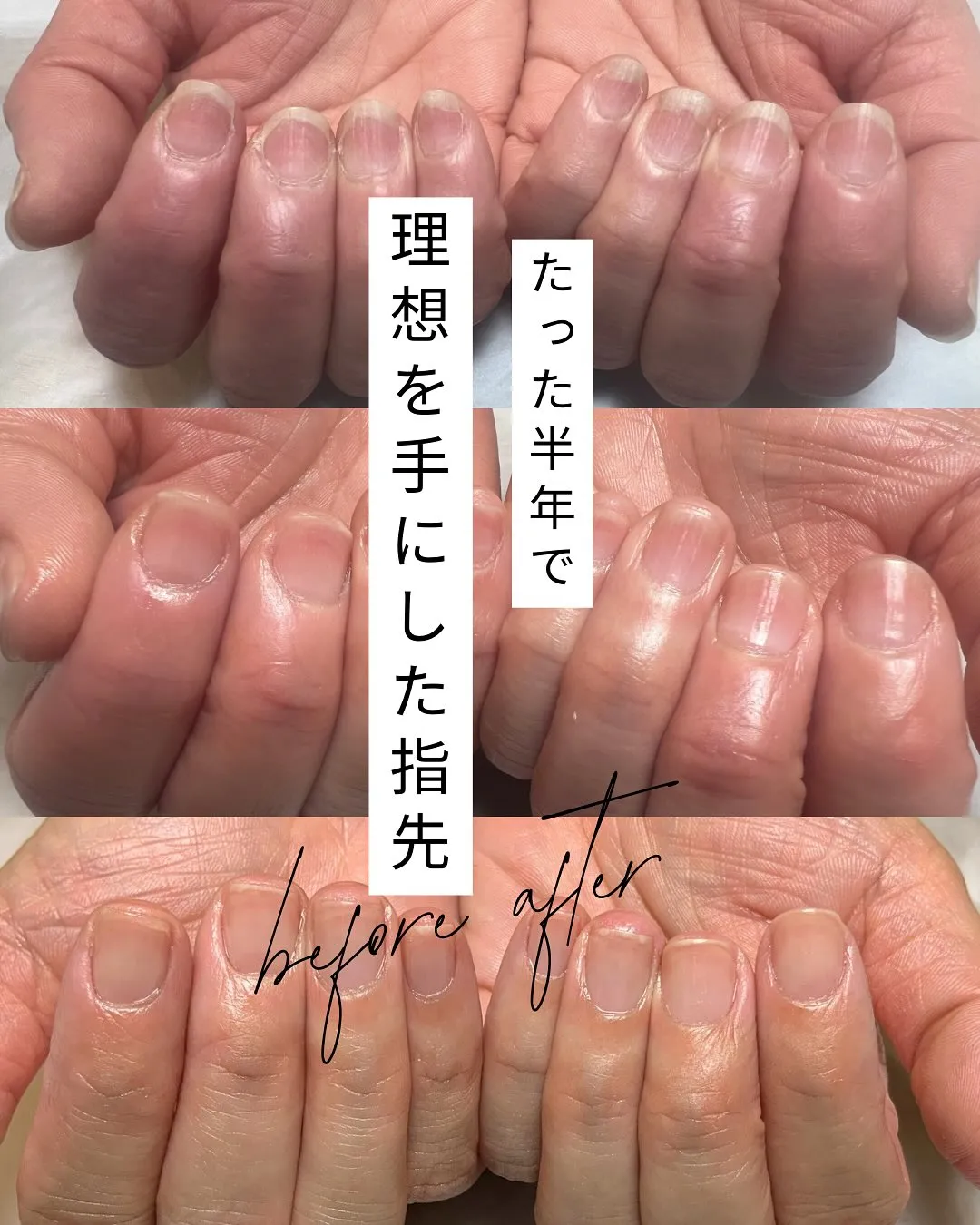 ネイルをしてもすぐに欠けてしまう…