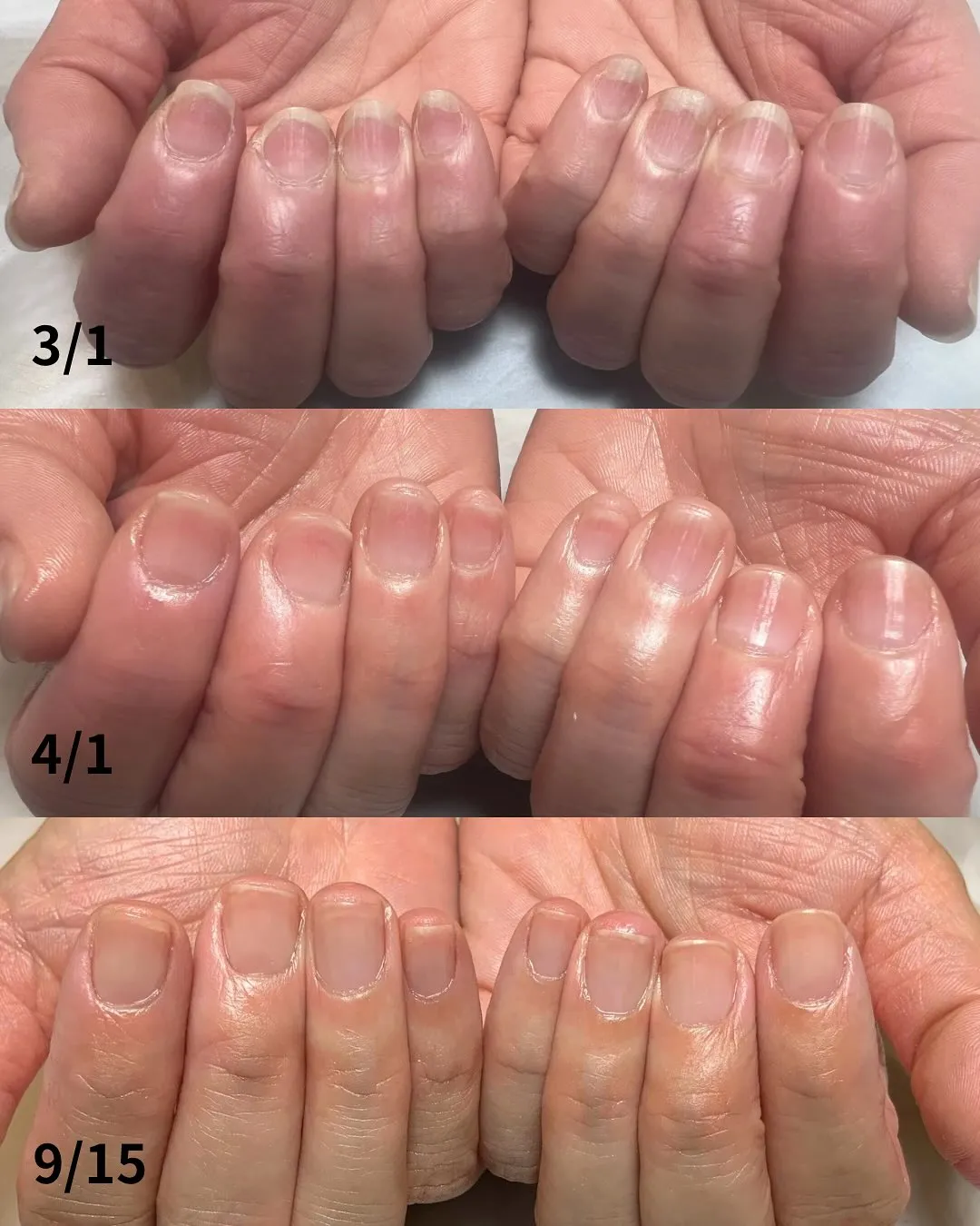 ネイルをしてもすぐに欠けてしまう…