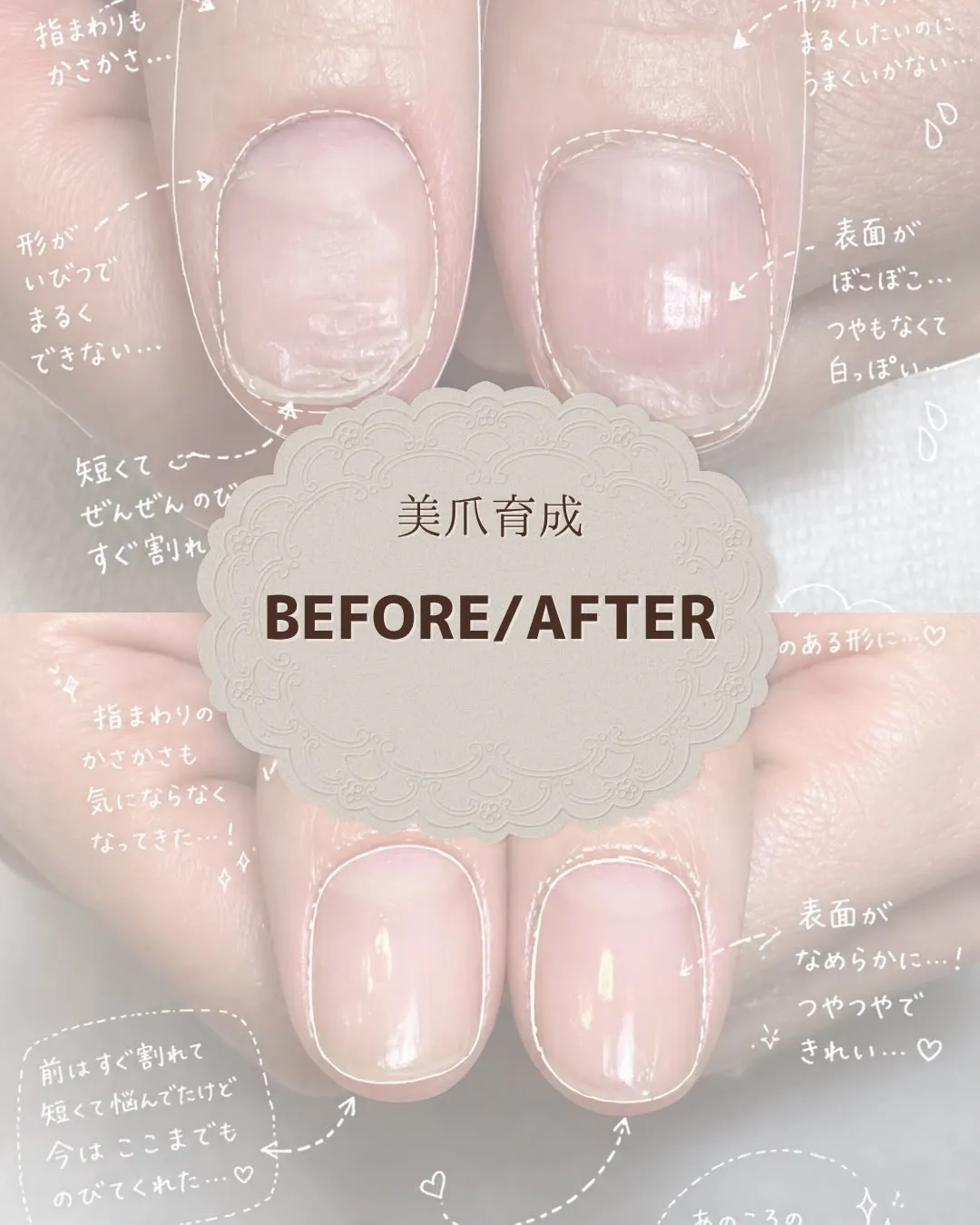 「爪なんて変わらない」と思っていませんか？🥺