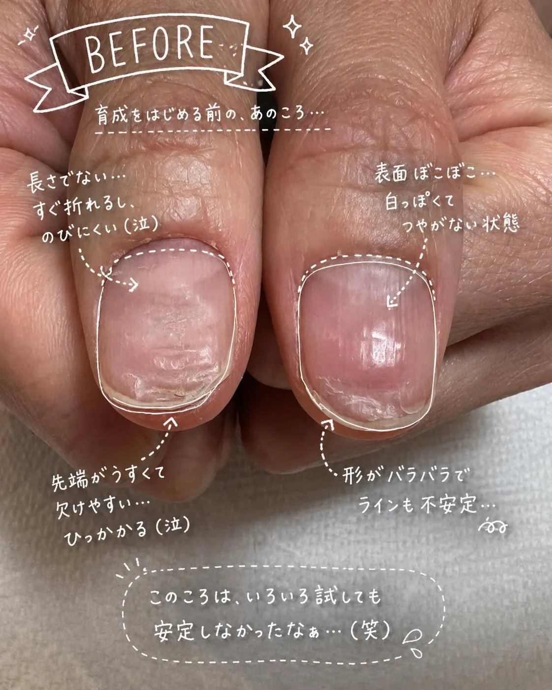 「爪なんて変わらない」と思っていませんか？🥺