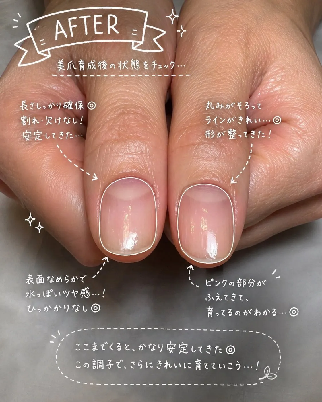 「爪なんて変わらない」と思っていませんか？🥺