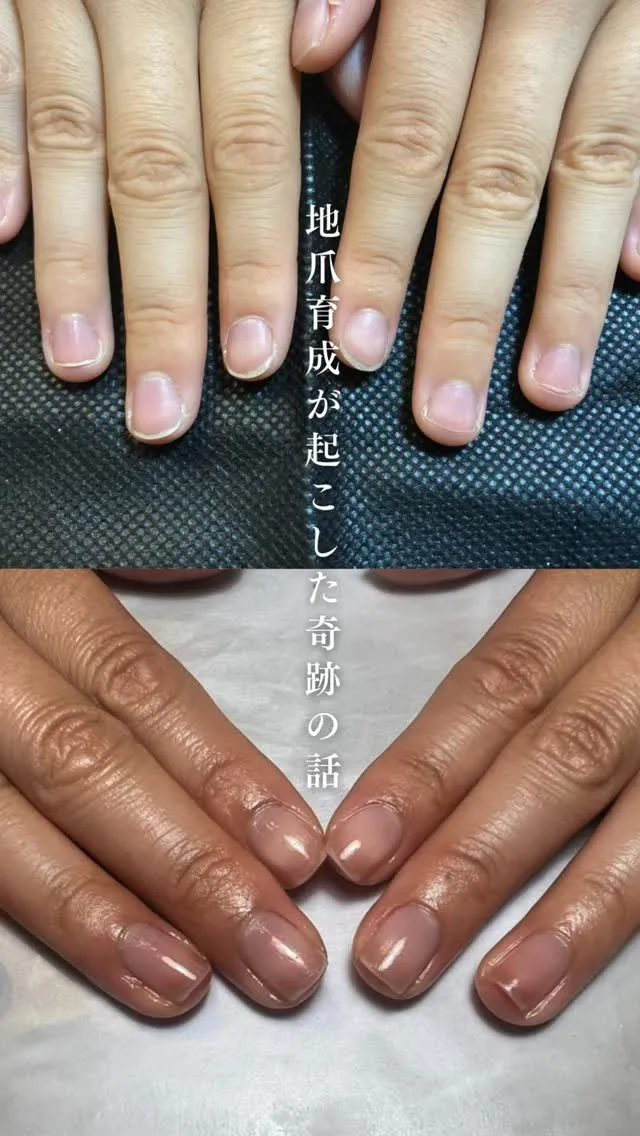 当店の地爪育成はネイルケアのみで爪を育てます。